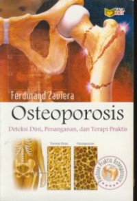 Image of Osteoporosis : deteksi dini, penanganan, dan terapi praktis