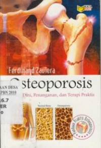 Image of Osteoporosis : Deteksi Dini, Penanganan, dan Terapi Praktis