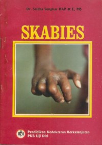 Image of Skabies