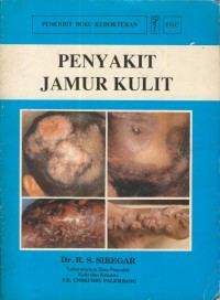 Image of Penyakit jamur kulit