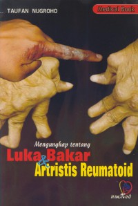 Mengungkap tentang luka bakar dan artristis reumatoid