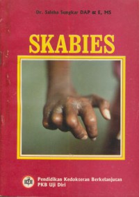 Skabies