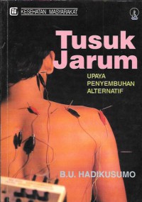 Tusuk jarum : upaya penyembuhan alternatif